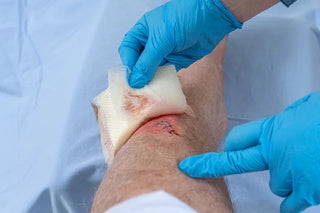 A Chronic Wound If Untreated